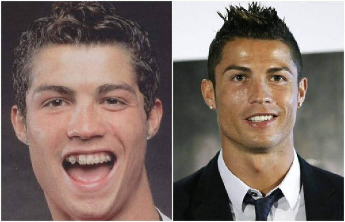 El antes y después de Cristiano Ronaldo