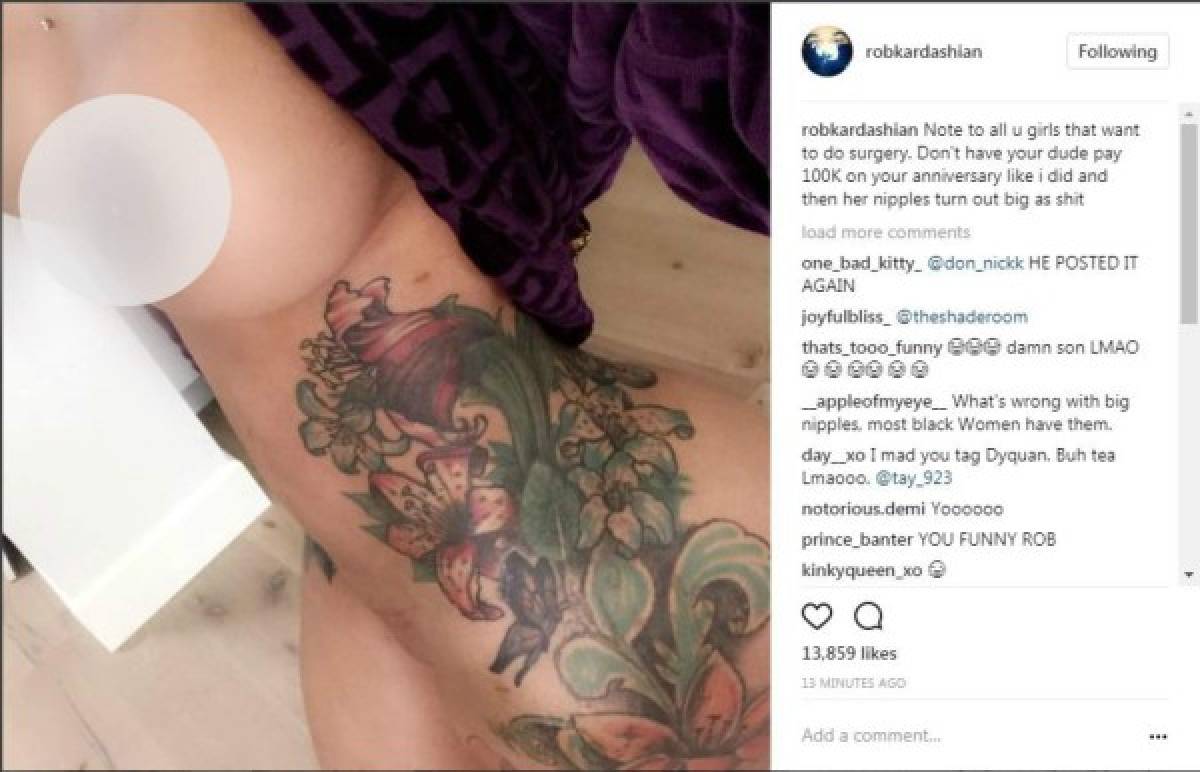 Rob Kardashian publica foto sin ropa de Blac Chyna