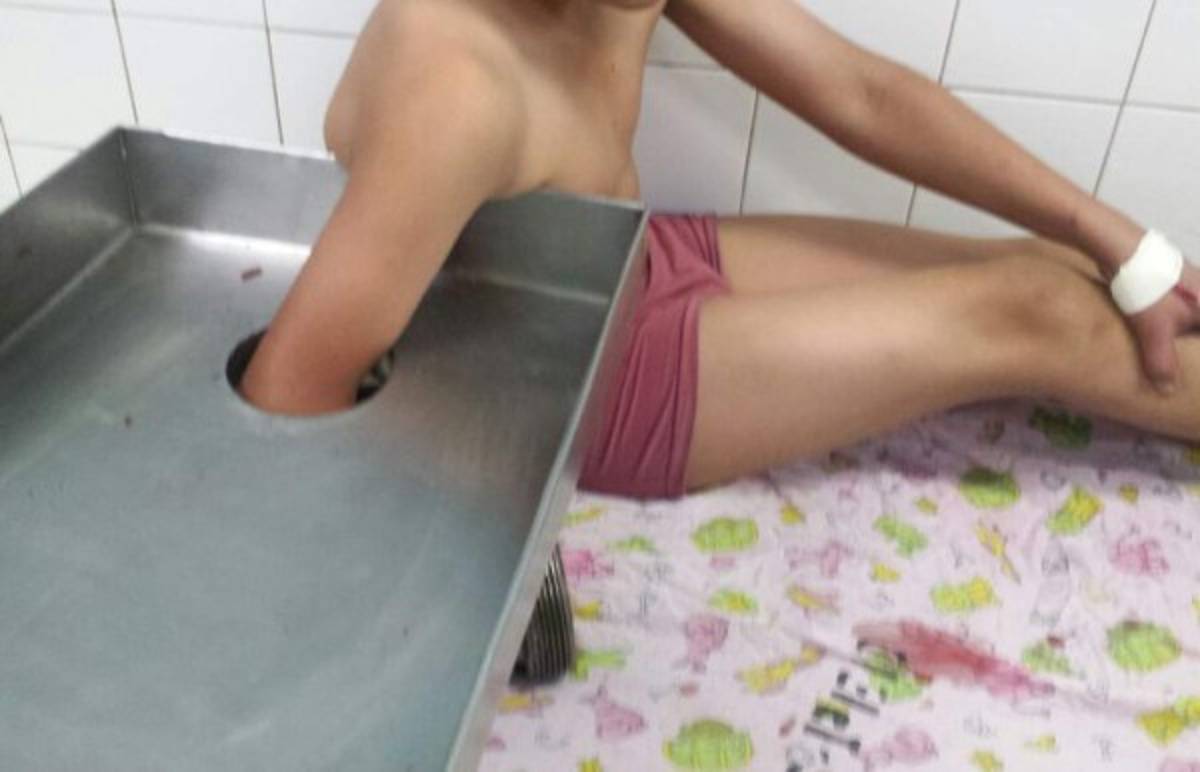 Molino eléctrico casi demuele mano derecha a un menor de edad en Comayagüela