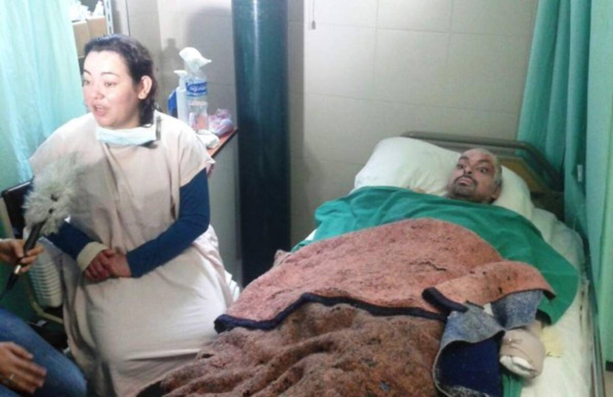 Dan de alta a último de los pacientes del incendio en Feria del Agricultor