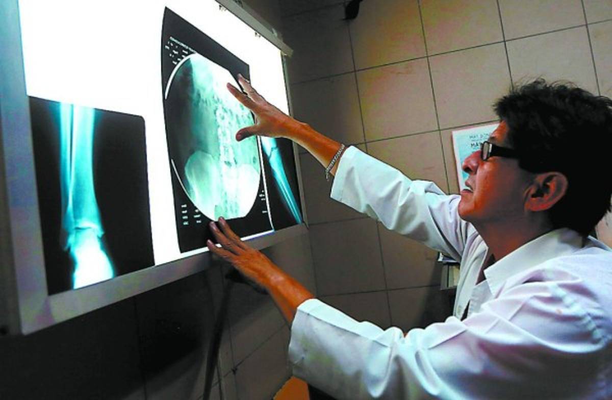 CES sin consenso para que se derogue reforma a Ley del IHSS