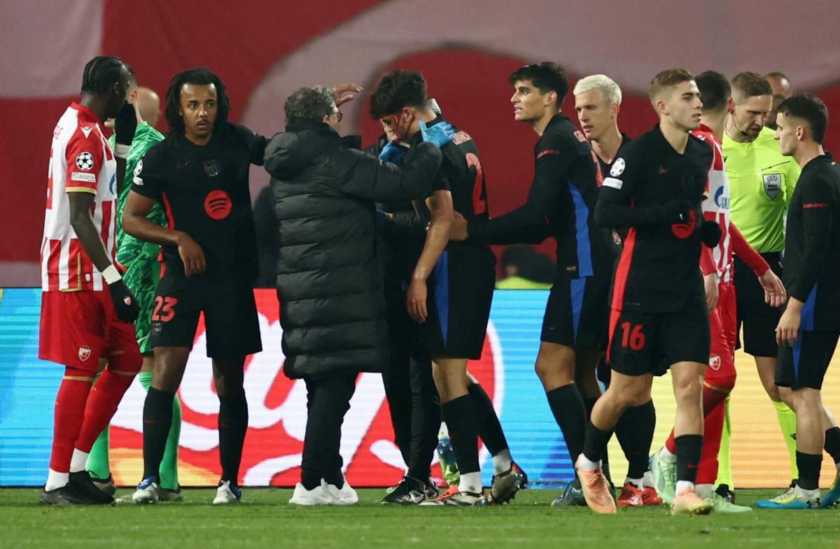 Fuertes imágenes: así quedó la cara de Pau Cubarsí tras recibir patada en Champions League Fuertes imágenes: así quedó la cara de Pau Cubarsí tras recibir patada en Champions League
