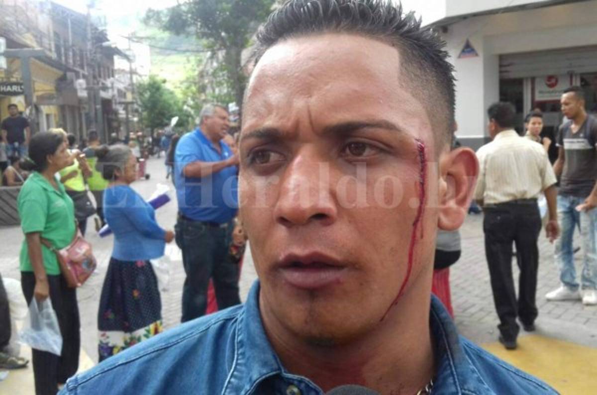 Vendedores ambulantes y policías municipales se enfrentan en el centro de Tegucigalpa