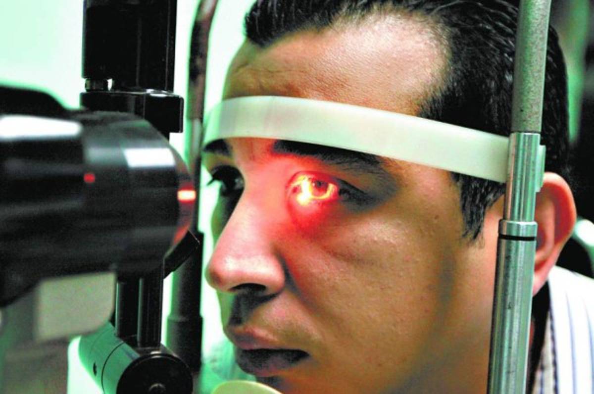 Honduras: En un 60 por ciento aumentan casos de conjuntivitis