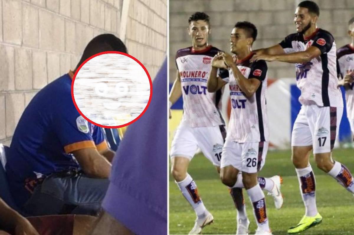 Futbolistas hondureños que han sido víctimas del racismo