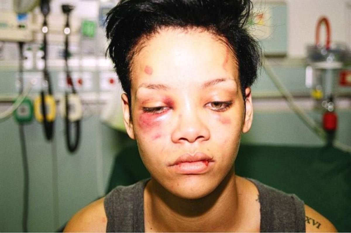 Chris Brown habla por primera vez sobre brutal golpiza a su expareja Rihanna