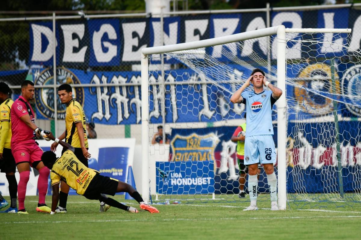 Fotos: Futbolista terminó jugando vendado, tristeza en el Génesis y las bellezas en el estadio