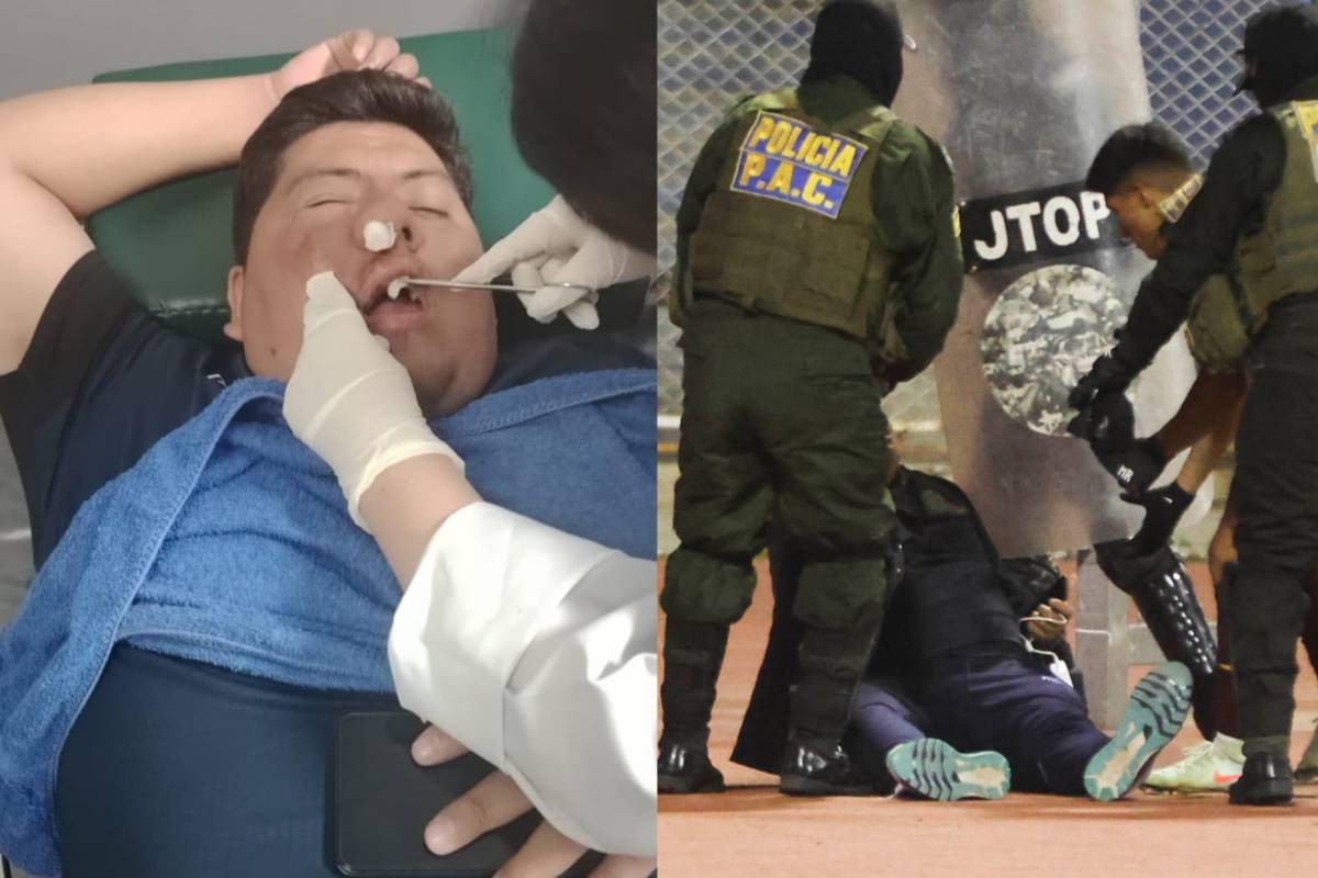 Partido de fútbol termina en batalla campal; 17 expulsados y directivo fracturado