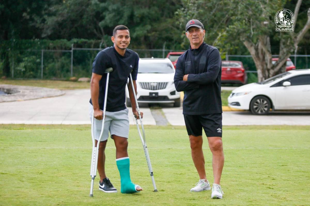 ¡Tres bajas! El modificado 11 titular de Olimpia para juego ante Juticalpa