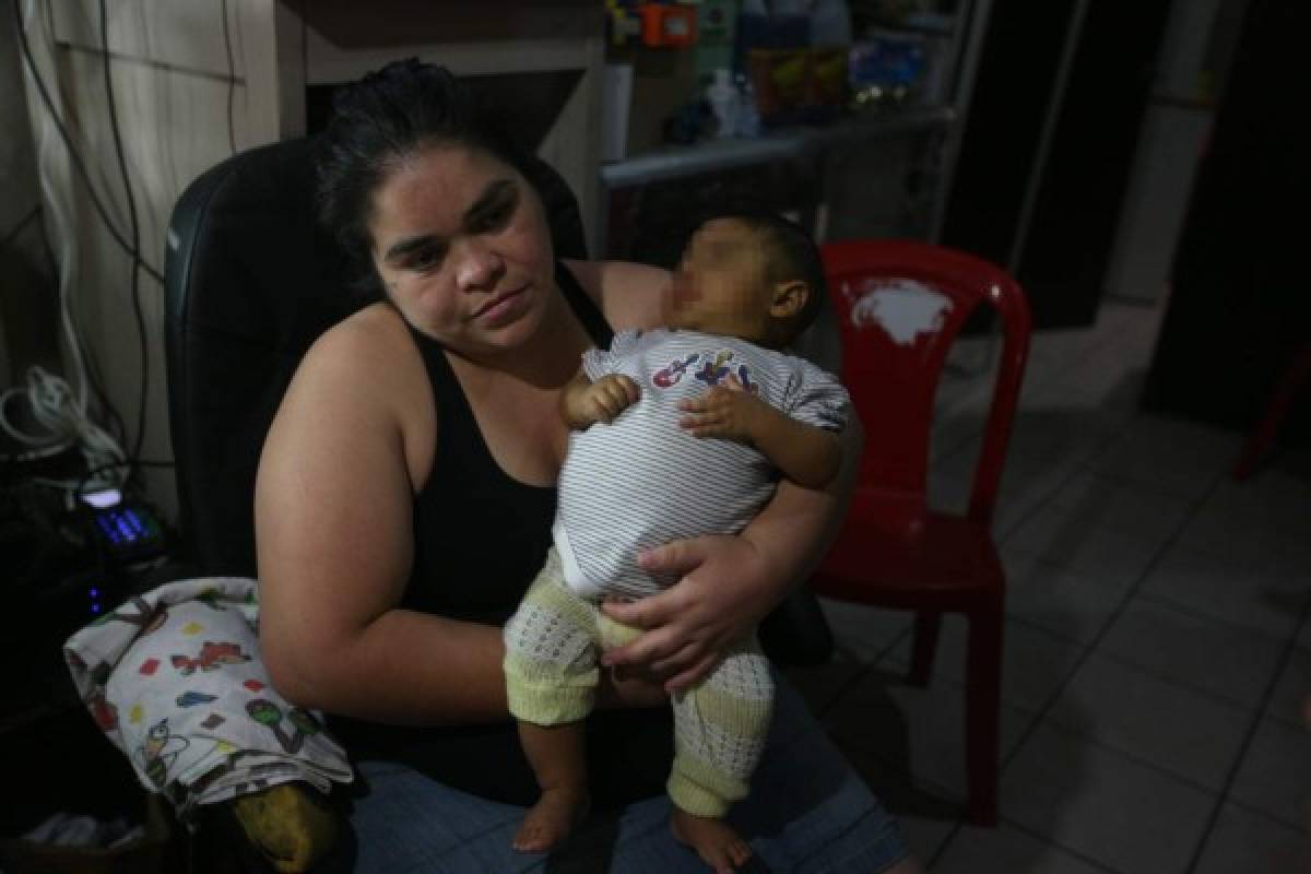 Niño hondureño de siete meses urge de un trasplante de hígado y su madre pide ayuda