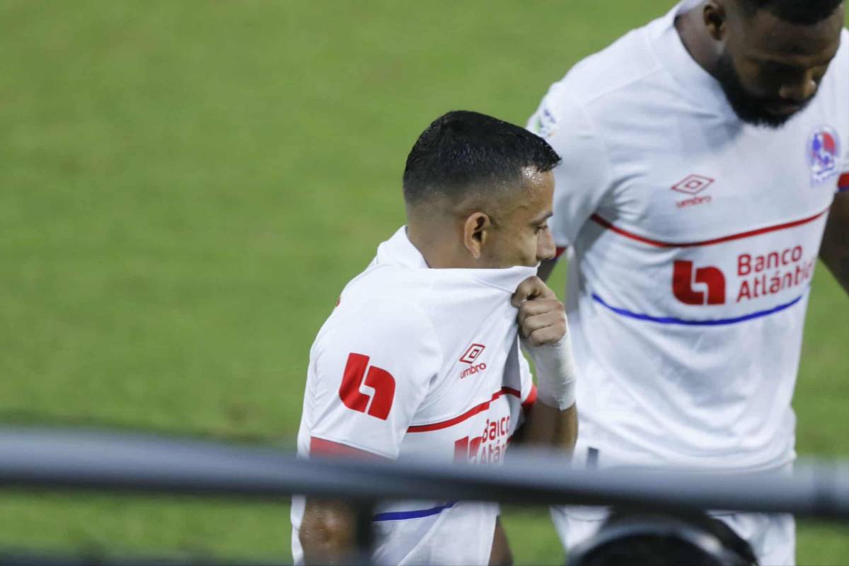 Show de la Ultra, lindas chicas, figura se lesiona y alegría por remontada de Olimpia en el Morazán