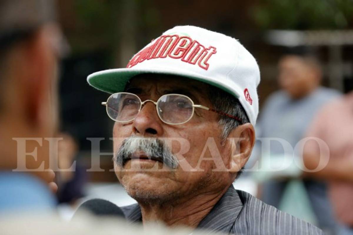 En Hospital Escuela mueren madre e hija quemadas en Santa Rosa de Copán
