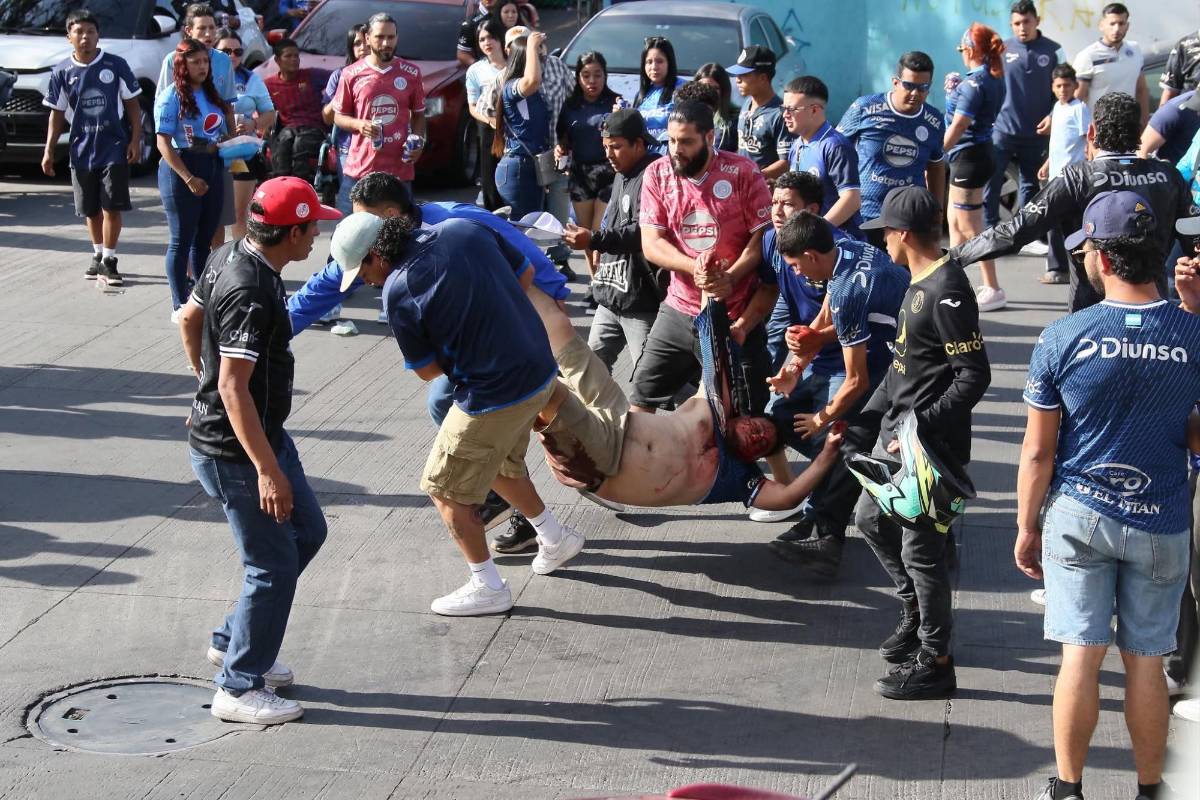 Oficial: Cantidad de casquillos de bala, heridos y daños tras pelea de barras de Olimpia y Motagua