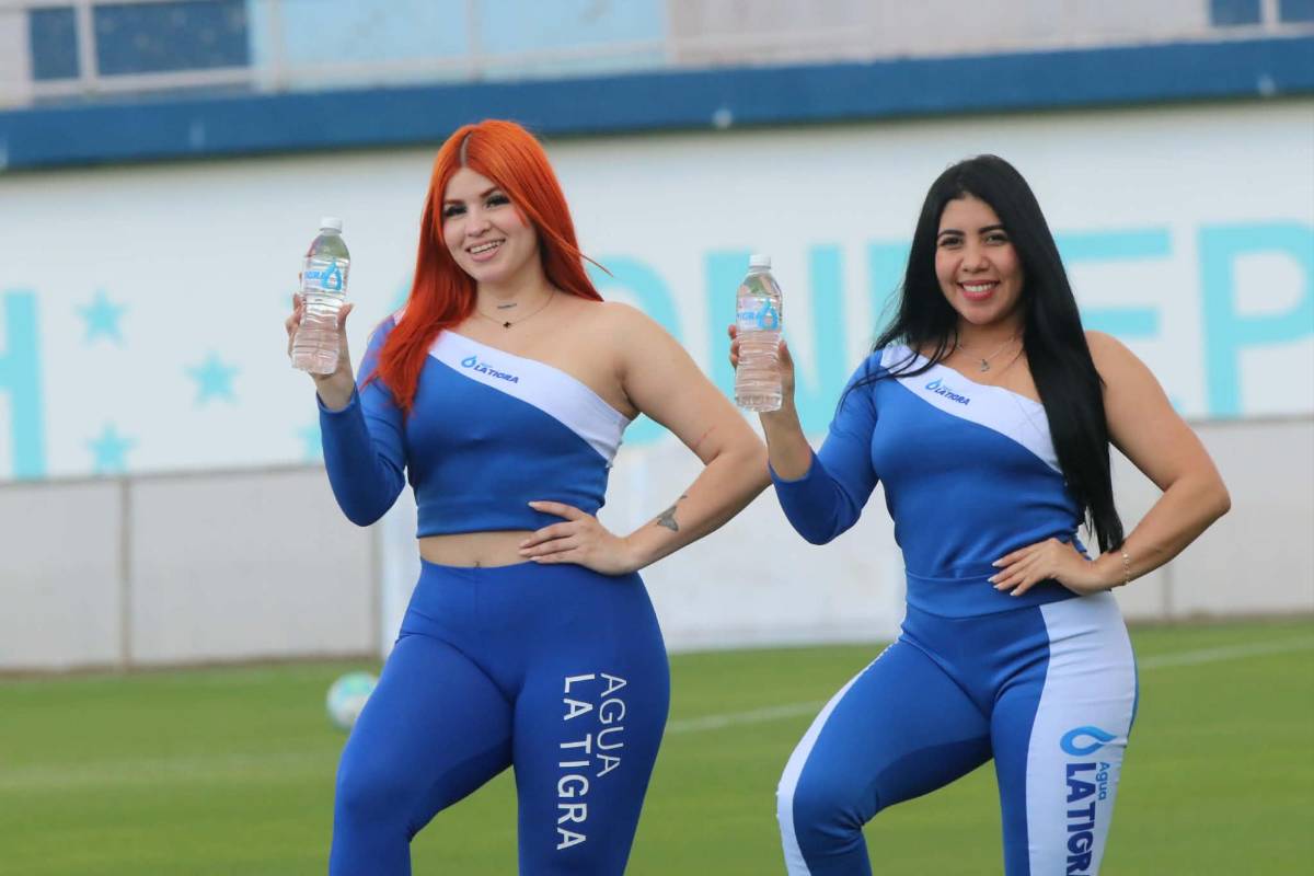 Chica y diputado sorprenden, lo que pasó con José Mario Pinto y tropiezo de Olimpia ante Olancho