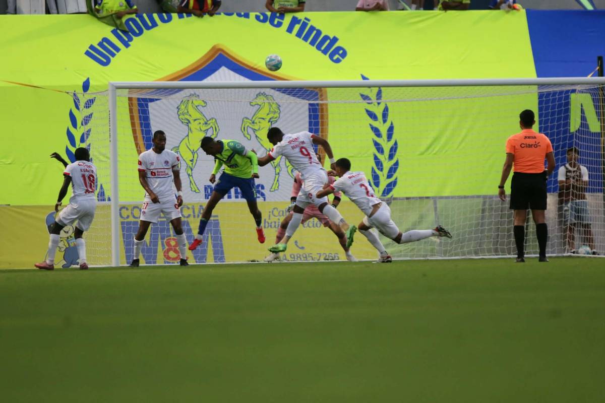 Chica y diputado sorprenden, lo que pasó con José Mario Pinto y tropiezo de Olimpia ante Olancho