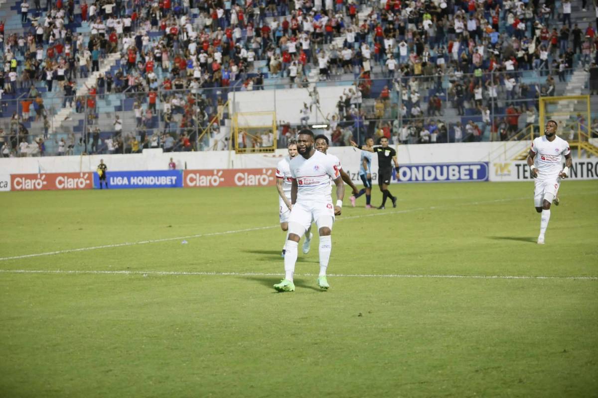 Show de la Ultra, lindas chicas, figura se lesiona y alegría por remontada de Olimpia en el Morazán