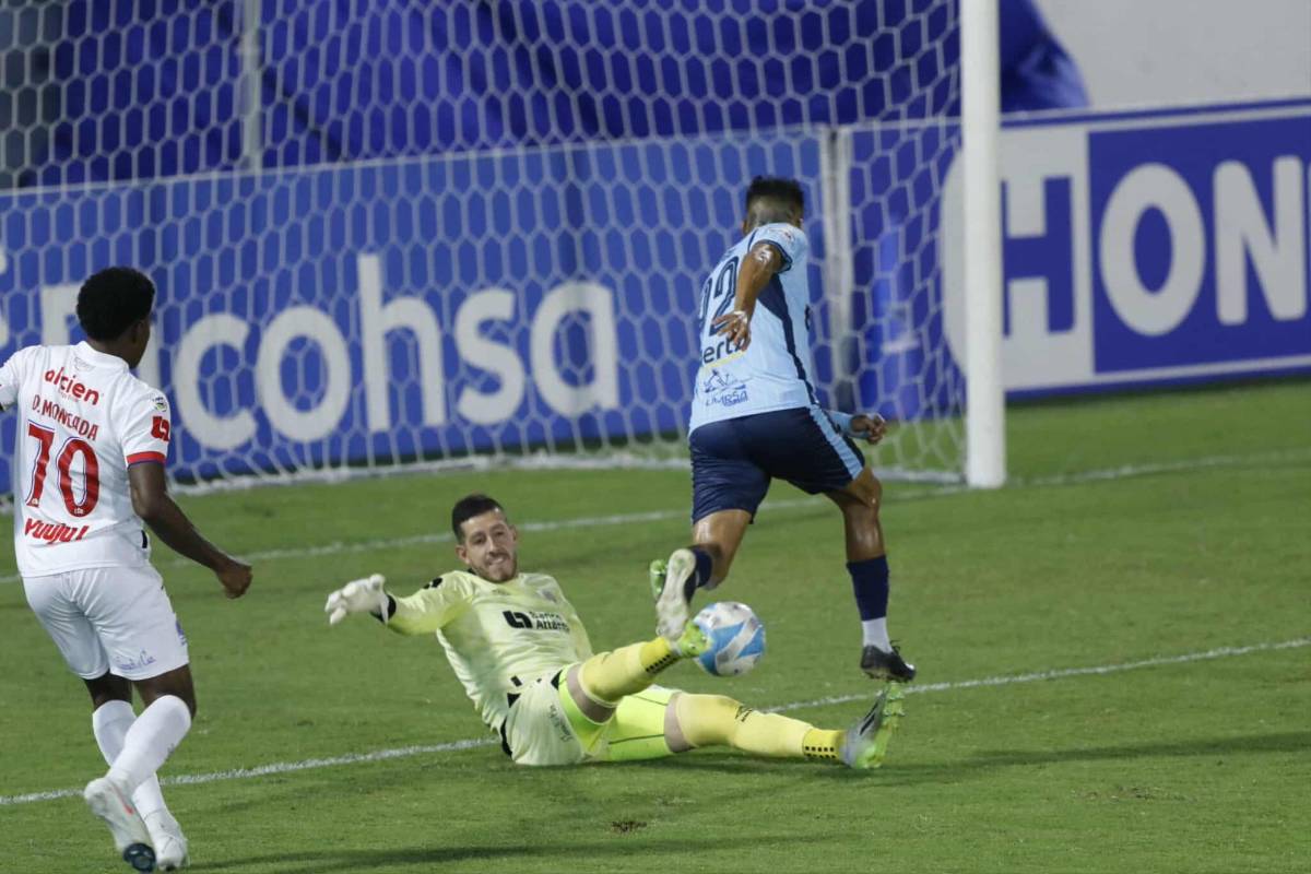 Show de la Ultra, lindas chicas, figura se lesiona y alegría por remontada de Olimpia en el Morazán