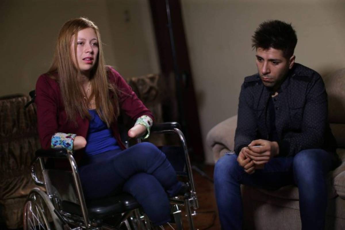 El testimonio de Shirley, la peruana que perdió brazos y piernas por negligencia médica