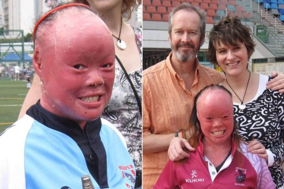 Escondió su rostro por 22 años