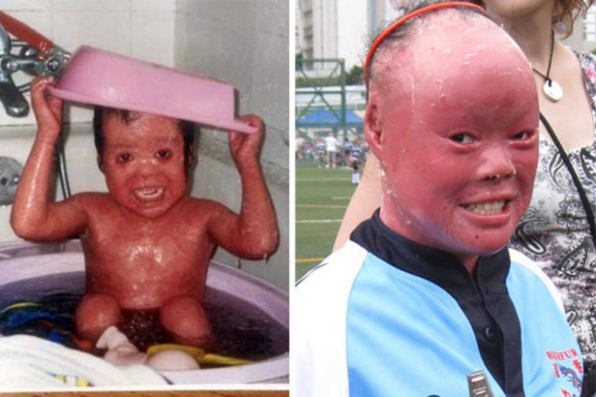 Escondió su rostro por 22 años