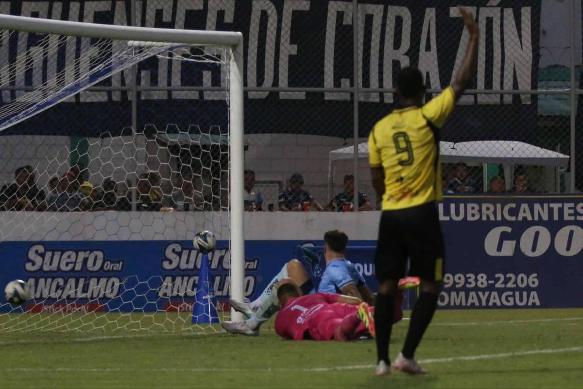 Fotos: Futbolista terminó jugando vendado, tristeza en el Génesis y las bellezas en el estadio