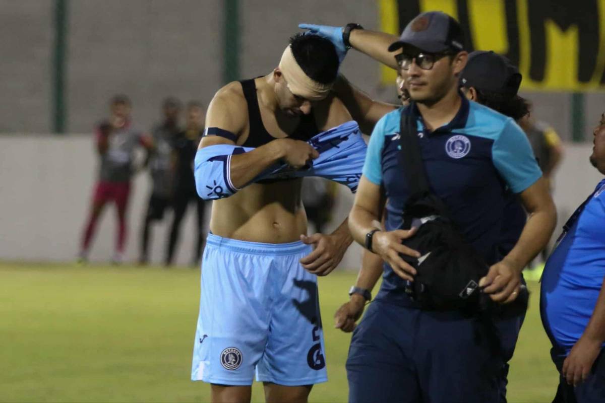 Fotos: Futbolista terminó jugando vendado, tristeza en el Génesis y las bellezas en el estadio