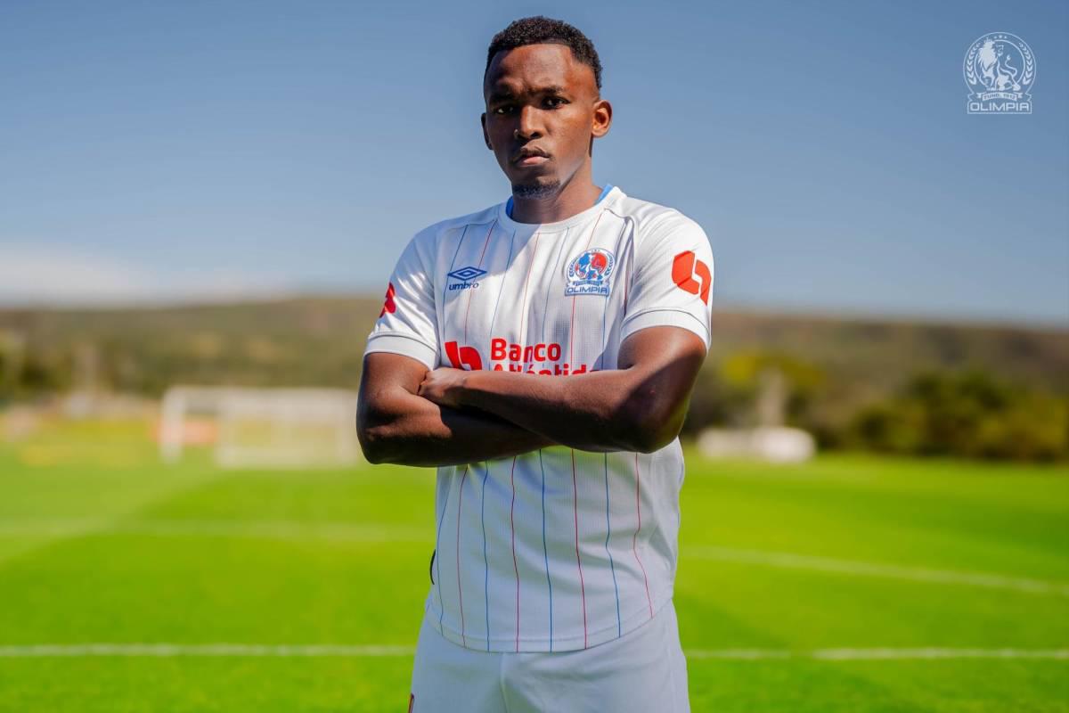 ¡Tres bajas! El modificado 11 titular de Olimpia para juego ante Juticalpa