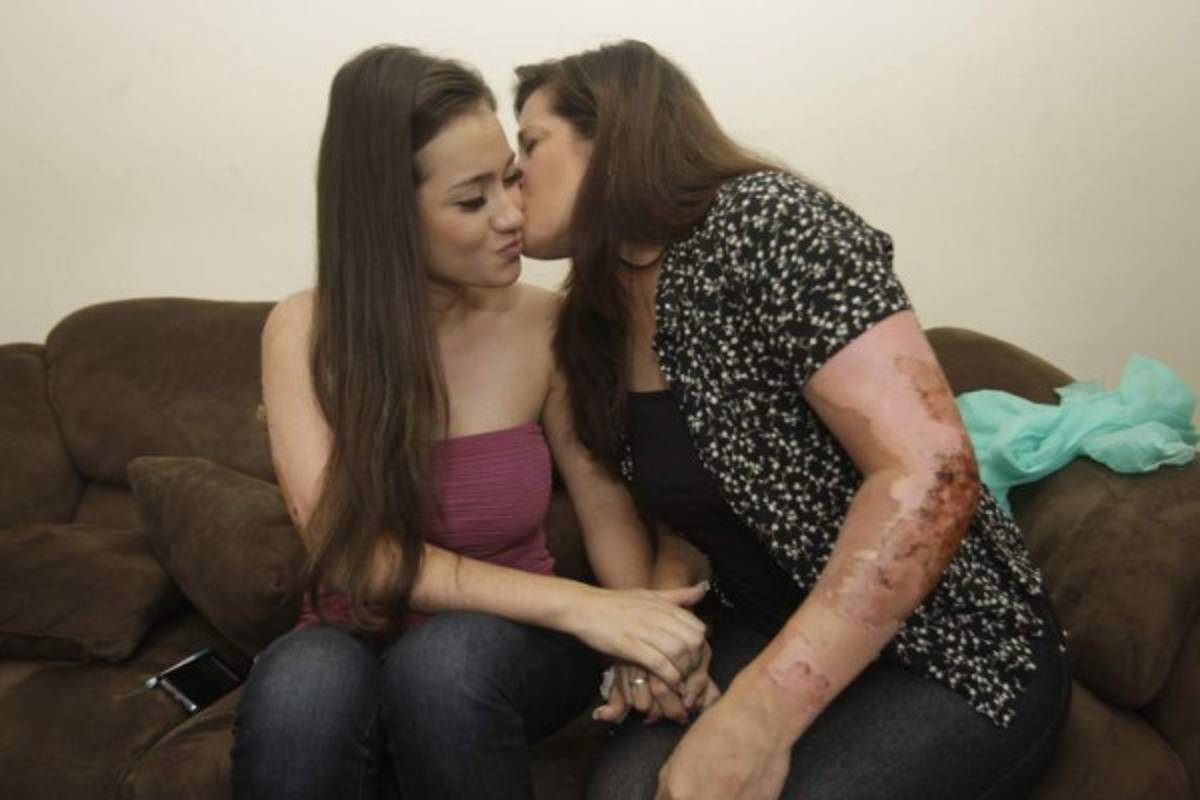 La bella modelo que sobrevivió a las llamas de la Feria del Agricultor