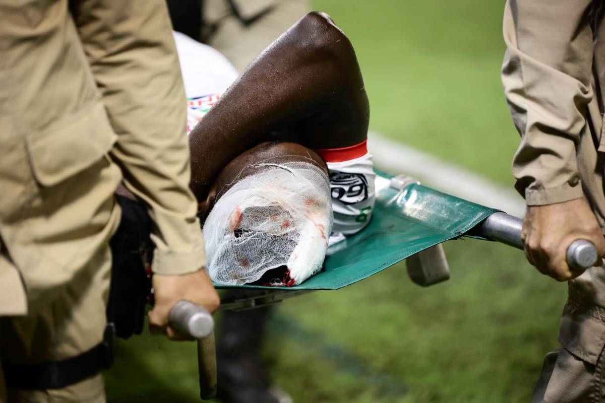 Bellas chicas cautivaron, jugador salió herido y la bronca de Real España en el Morazán