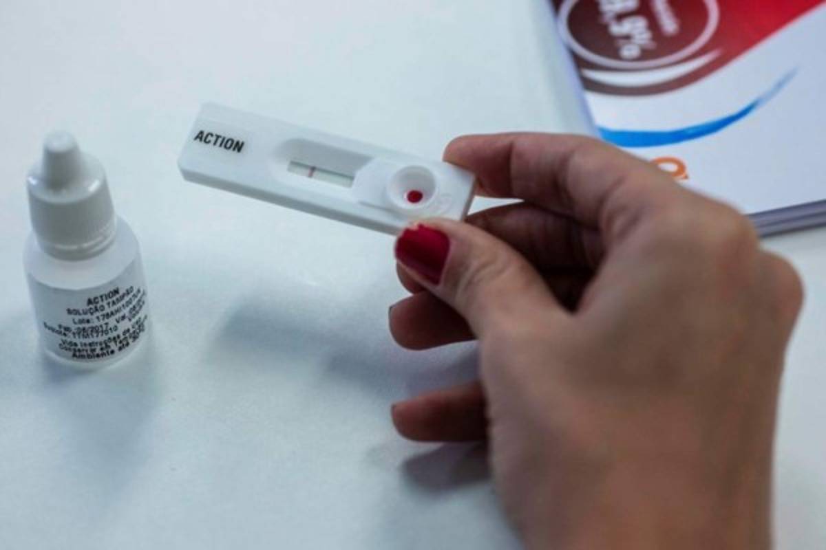 Dos rayitas indican que una persona es seropositiva. Foto AFP