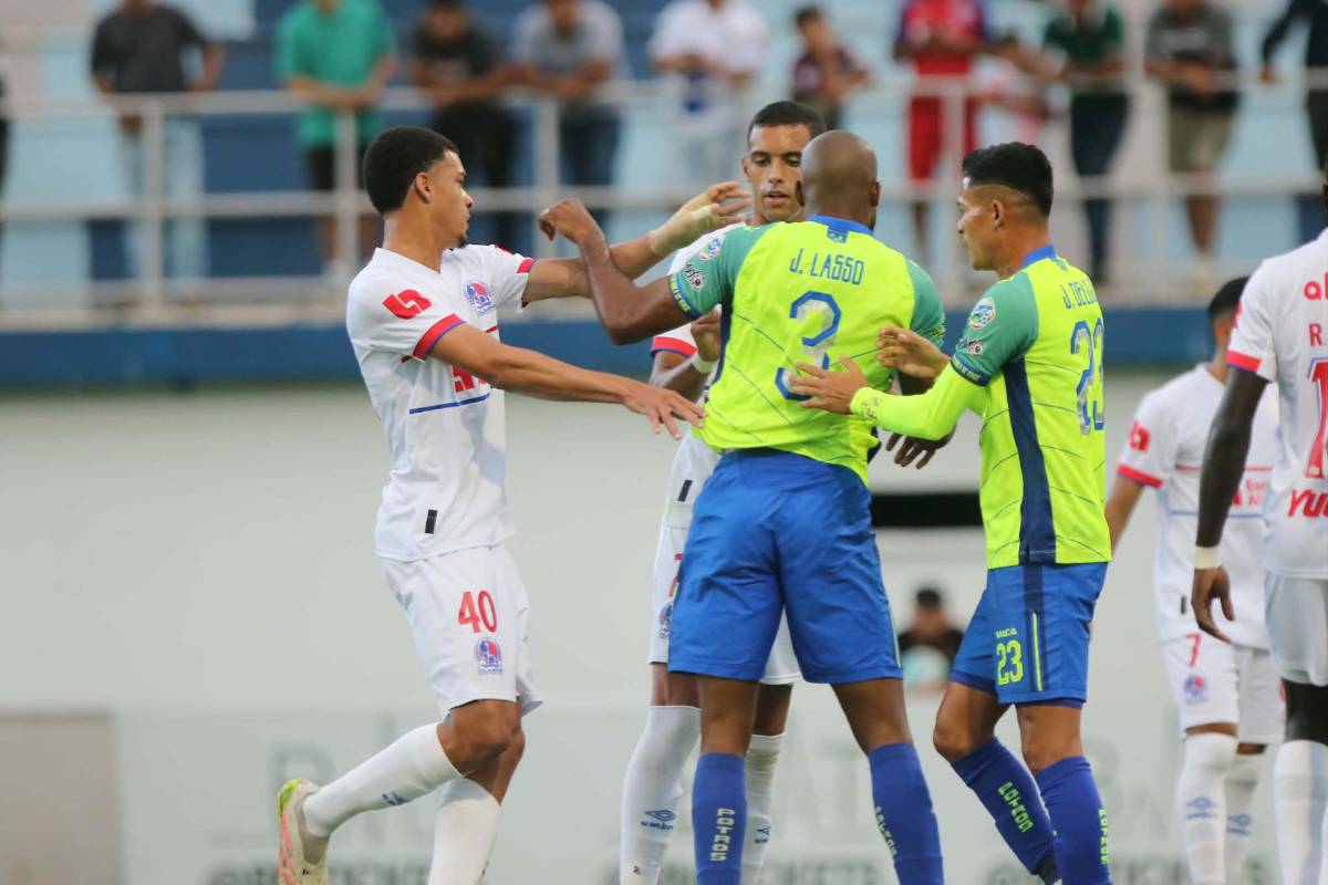 Chica y diputado sorprenden, lo que pasó con José Mario Pinto y tropiezo de Olimpia ante Olancho