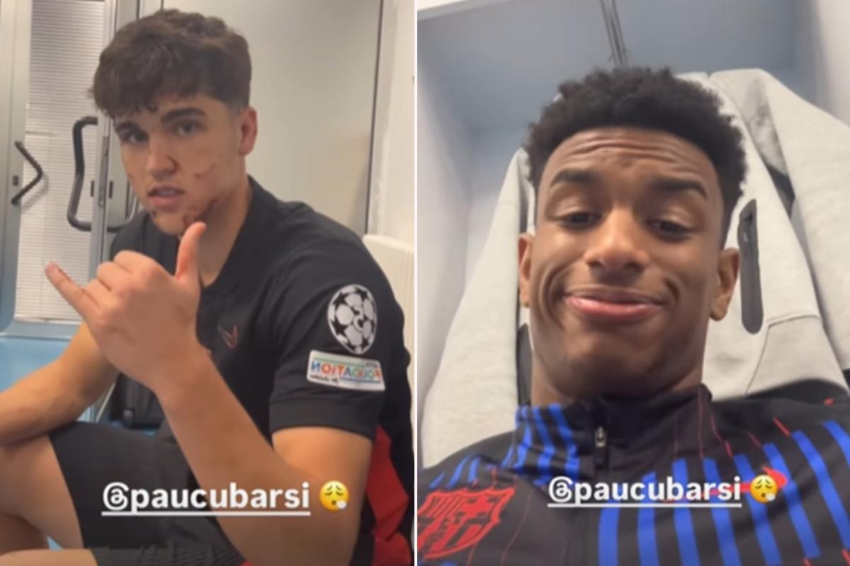 Fuertes imágenes: así quedó la cara de Pau Cubarsí tras recibir patada en Champions League Fuertes imágenes: así quedó la cara de Pau Cubarsí tras recibir patada en Champions League