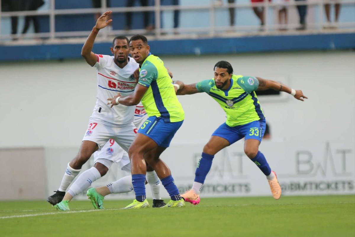 Chica y diputado sorprenden, lo que pasó con José Mario Pinto y tropiezo de Olimpia ante Olancho