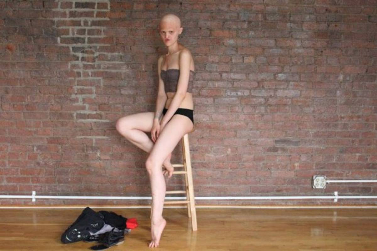 Modelo con inusual apariencia rompe estereotipos de belleza