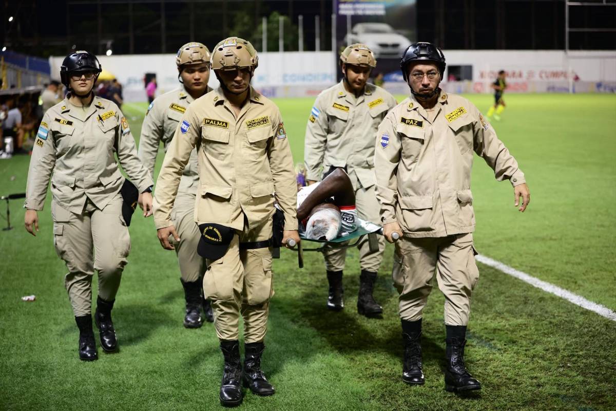 Bellas chicas cautivaron, jugador salió herido y la bronca de Real España en el Morazán