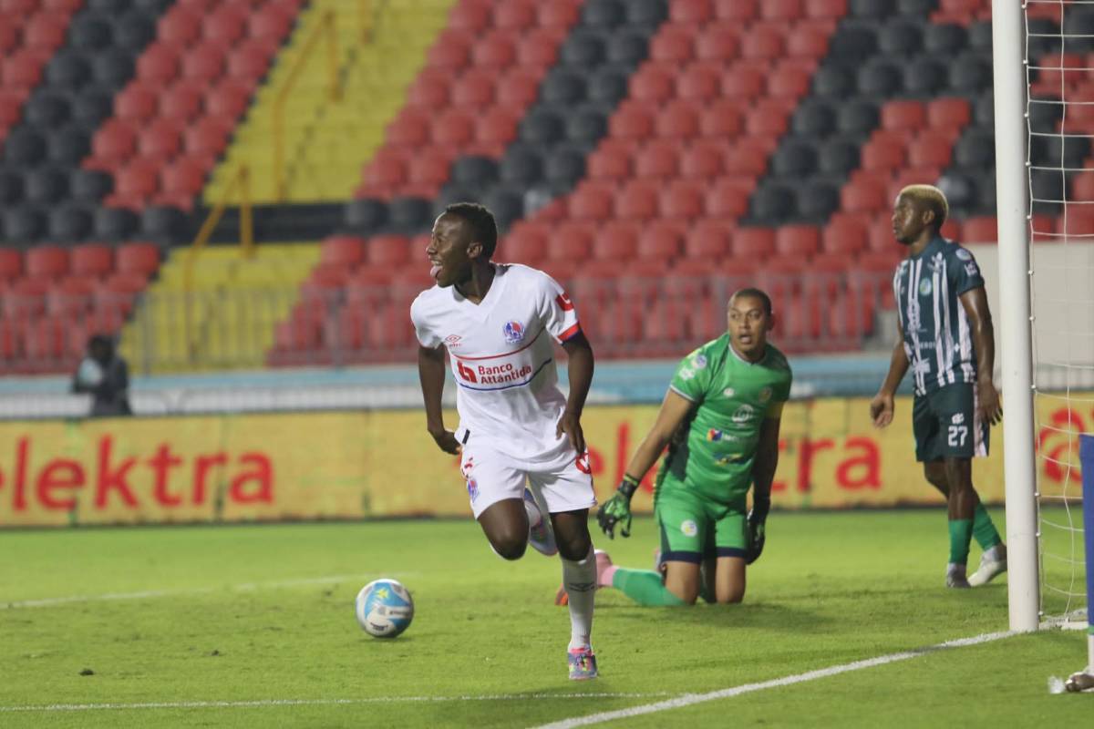 Lindas chicas, el error de Espinel y e increíble tropiezo de Olimpia ante Juticalpa en el Nacional