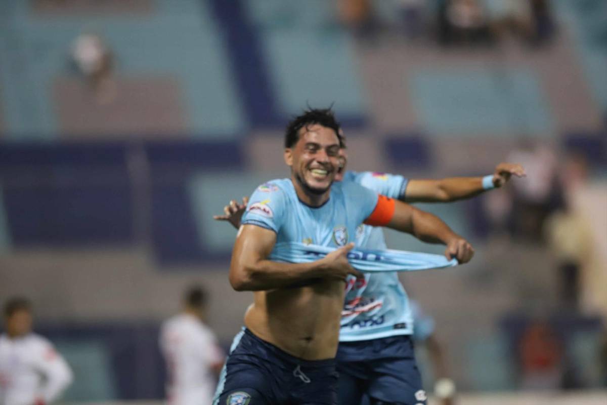 Show de la Ultra, lindas chicas, figura se lesiona y alegría por remontada de Olimpia en el Morazán