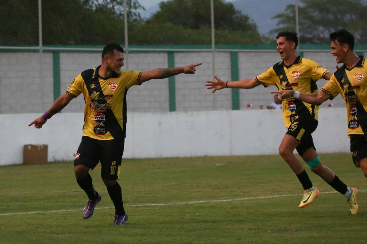 Fotos: Futbolista terminó jugando vendado, tristeza en el Génesis y las bellezas en el estadio