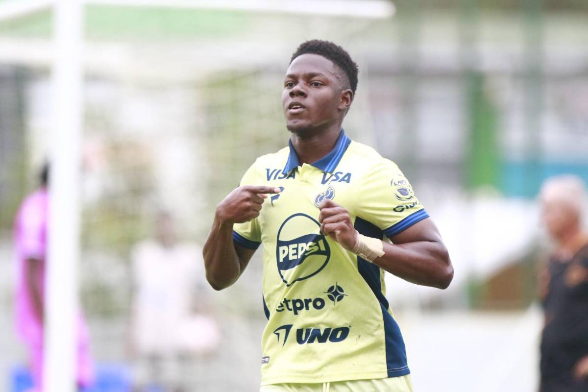 Mamita en el Excélsior, inesperada visita y tristeza de Platense tras caer ante Motagua