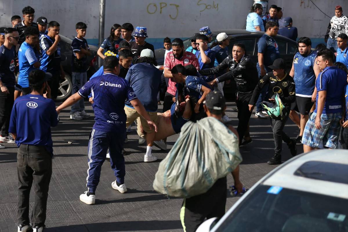 En fotos: Heridos, disparos y un caos total en las afueras del Nacional previo al Motagua vs Olimpia