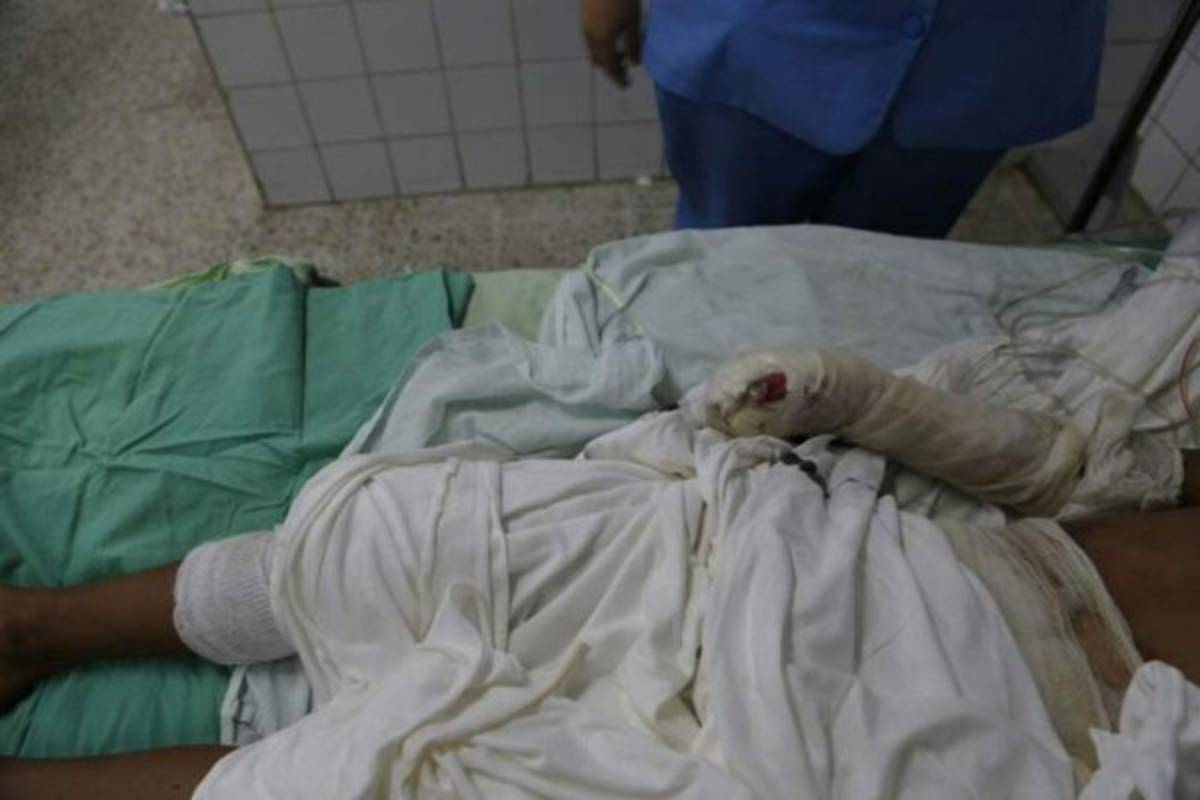 Honduras: 24 pacientes mutilados dejó la Navidad