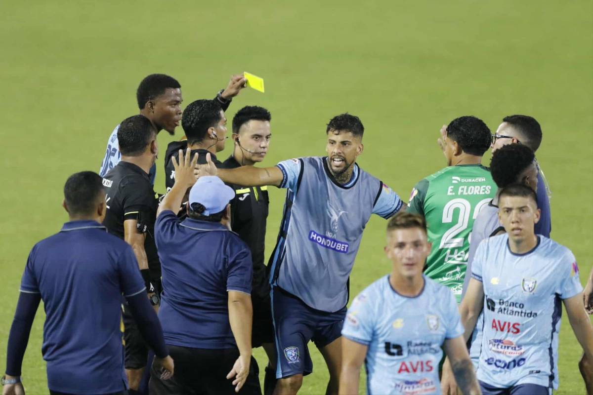 Show de la Ultra, lindas chicas, figura se lesiona y alegría por remontada de Olimpia en el Morazán