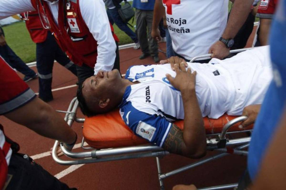 Luis Garrido sufre una molestia en la rodilla derecha, la misma que se lesionó ante México