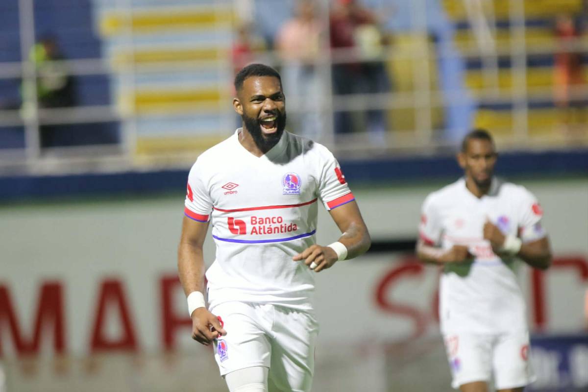 Chica y diputado sorprenden, lo que pasó con José Mario Pinto y tropiezo de Olimpia ante Olancho