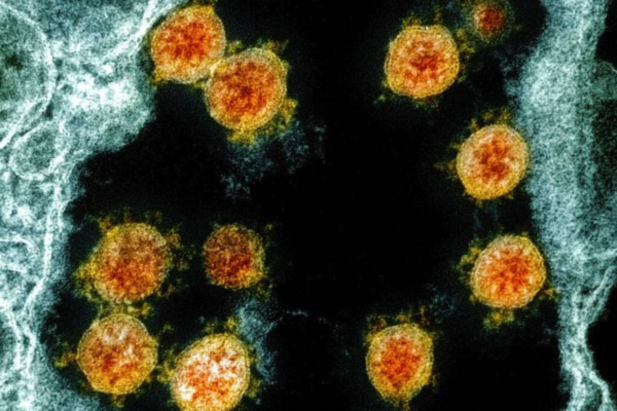 Sistema inmunológico ofrece claves sobre reacción al coronavirus