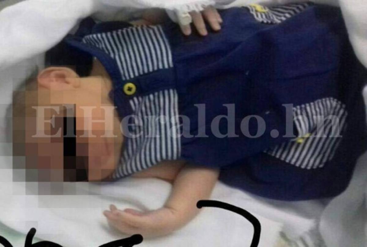 Honduras: Salud declara emergencia por casos de microcefalia en Choluteca