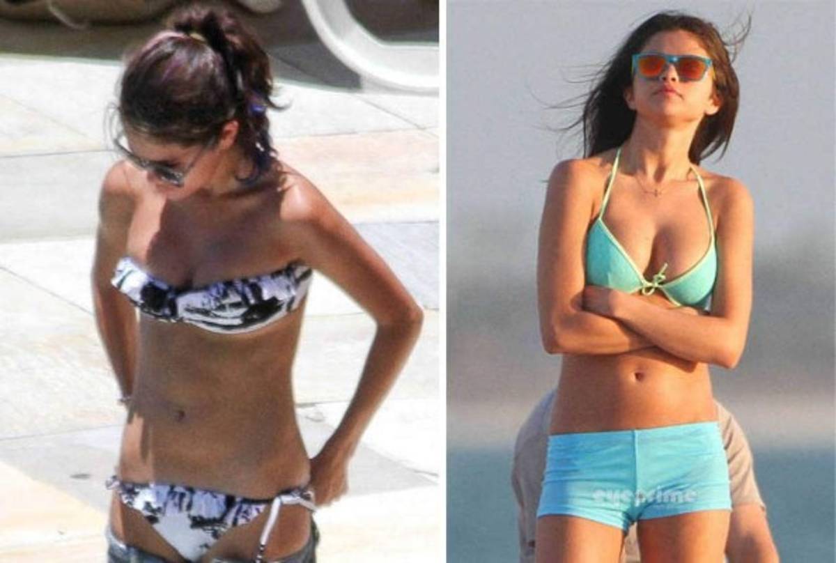 Los senos renovados de Selena Gomez