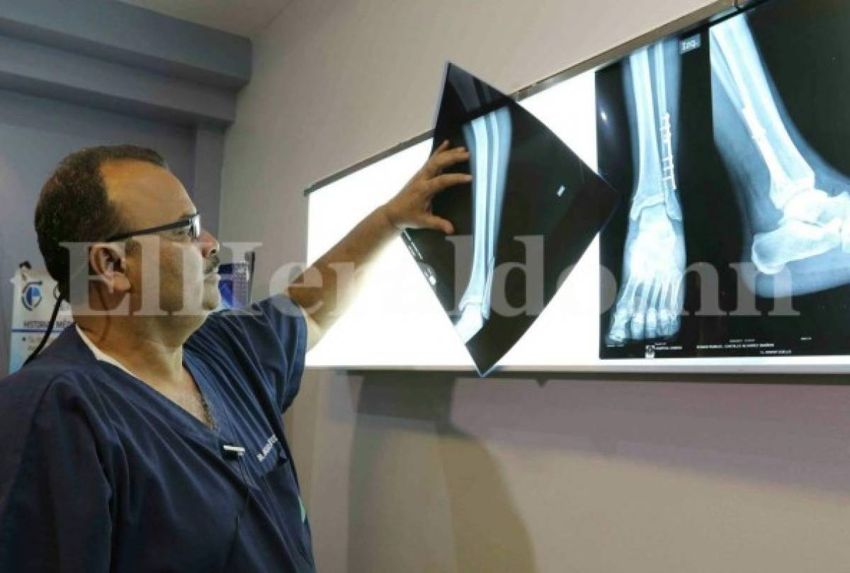 Al goleador hondureño se le aplicó una placa y un tornillo. En la imagen, el doctor a cargo muestra una radiografía de la pierna de Castillo, foto: Go Deportes.