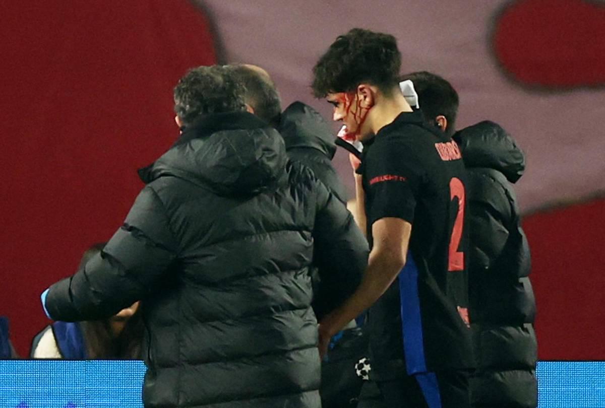 Fuertes imágenes: así quedó la cara de Pau Cubarsí tras recibir patada en Champions League Fuertes imágenes: así quedó la cara de Pau Cubarsí tras recibir patada en Champions League