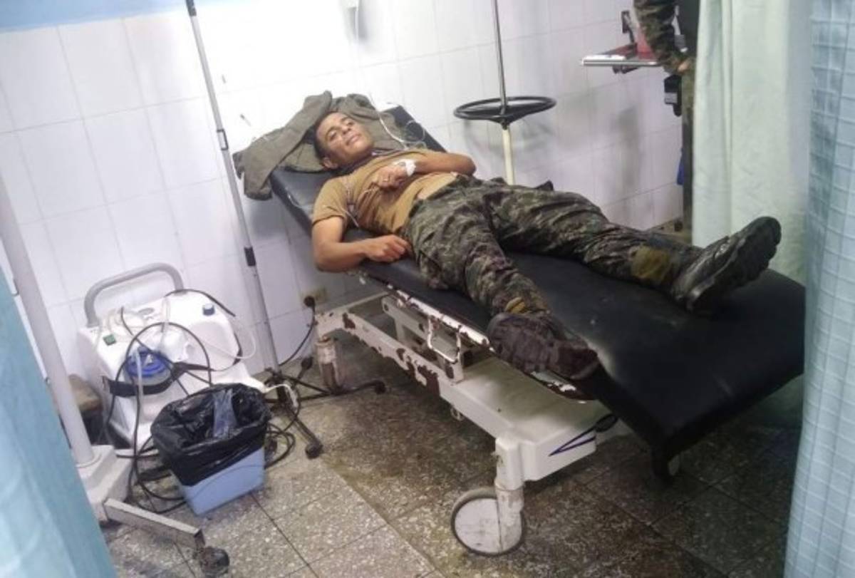 Cuatro agentes del orden resultan heridos durante desalojo de manifestantes